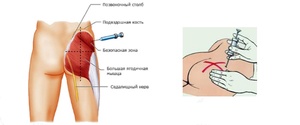 Синяки после укола